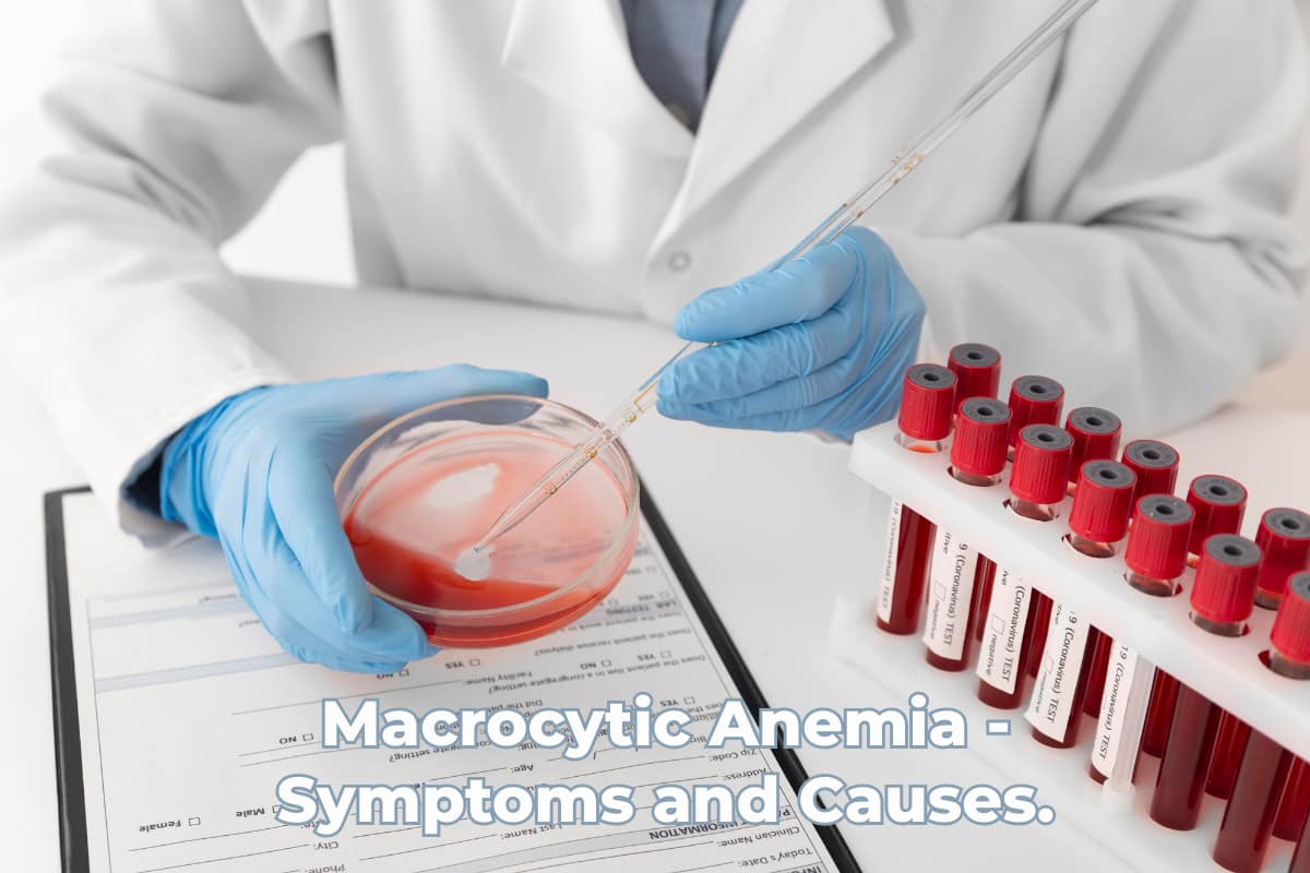 Macrocytic Anemia - Symptoms and Causes.